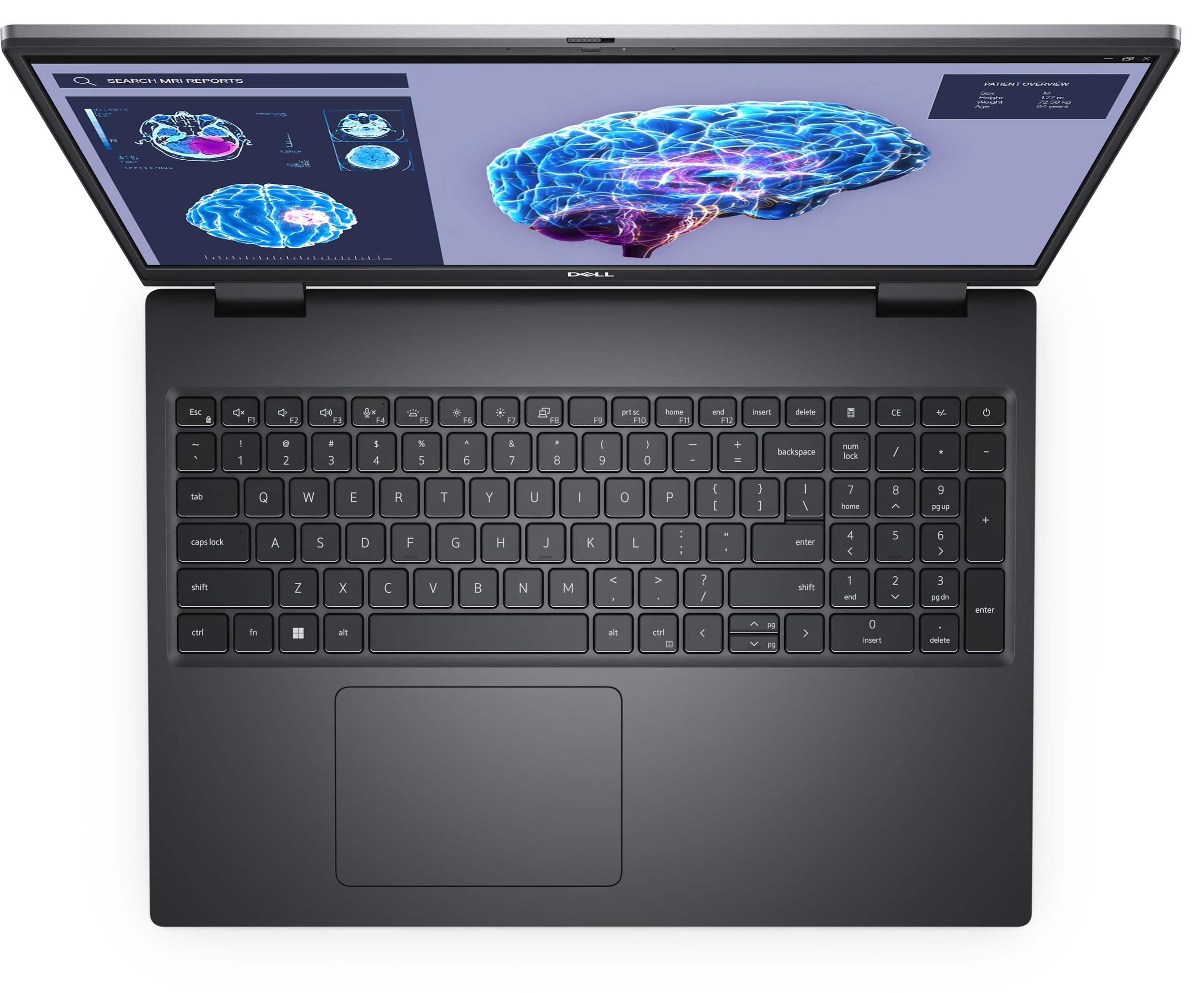 Dell Mobile Precision Workstation 7680 | 16 " | WVA | FHD+ | 1920 x 1200 pixels | Anti-glare | Intel Core i9 | i9-13950HX | 32 GB | Solid-state drive capacity 1000 GB | NVIDIA RTX 2000 Ada | GDDR6 | 8 GB | Windows 11 Pro | 802.11ax | Keyboard language Eng