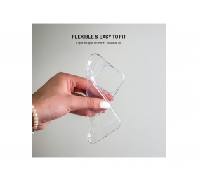 Fixed Story AntiUV | Back cover | Xiaomi | 17 | TPU | Clear
